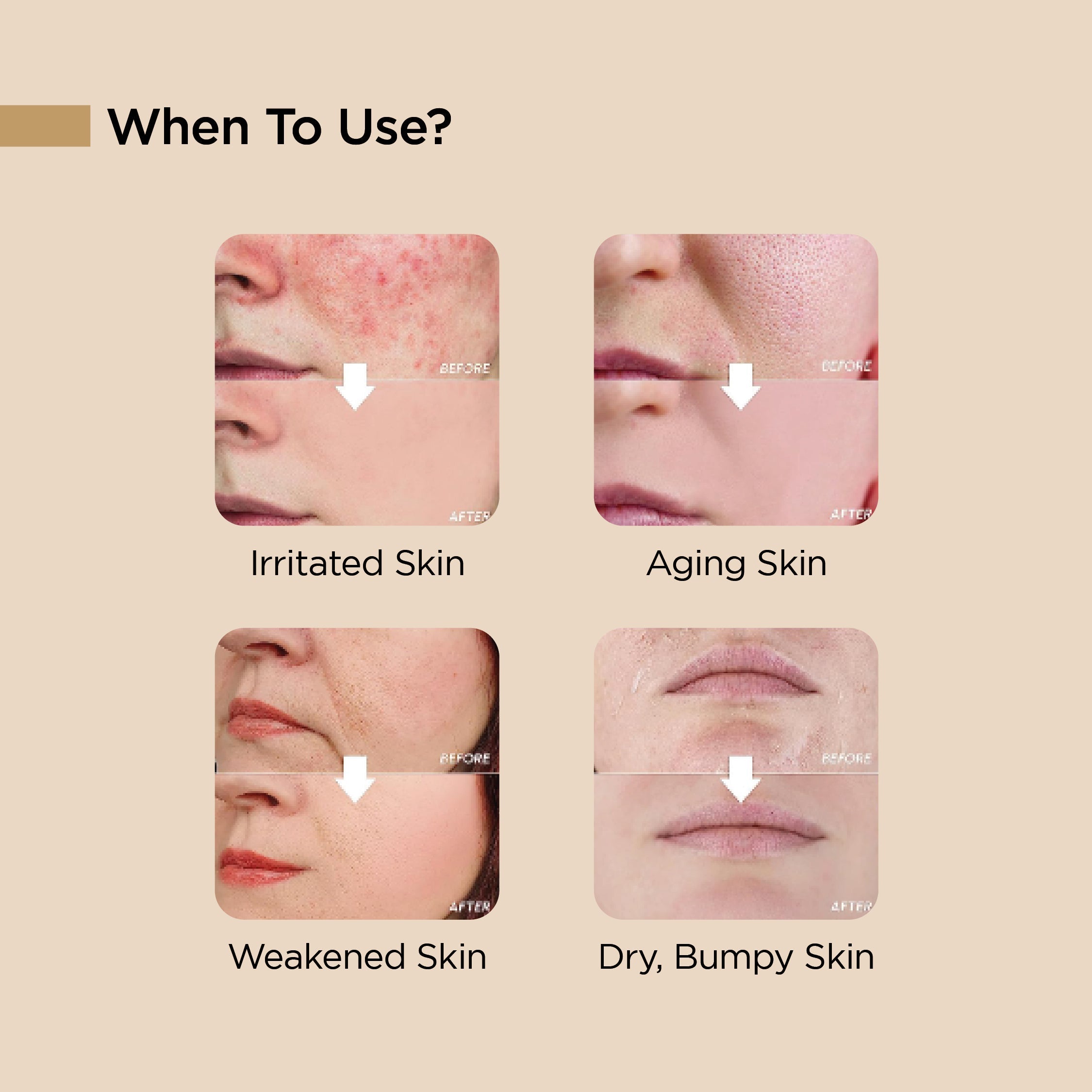 top face serums